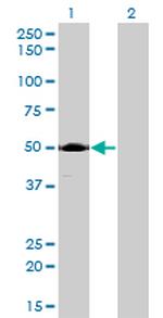 ACP2 Antibody in Western Blot (WB)