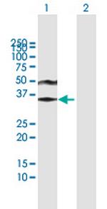 ACRV1 Antibody in Western Blot (WB)