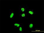 ACTN4 Antibody in Immunocytochemistry (ICC/IF)