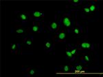 ACTN4 Antibody in Immunocytochemistry (ICC/IF)