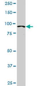 ACTN4 Antibody in Western Blot (WB)