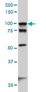 ACTN4 Antibody in Western Blot (WB)
