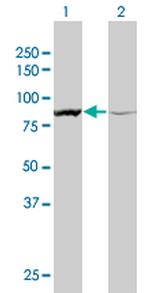 ACTN1 Antibody in Western Blot (WB)