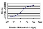 ACVR1B Antibody in ELISA (ELISA)