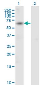 ACVR1B Antibody in Western Blot (WB)