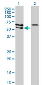 ACVRL1 Antibody in Western Blot (WB)