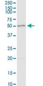 ADA Antibody in Western Blot (WB)