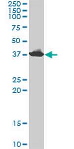 ADA Antibody in Western Blot (WB)