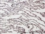 ADAR Antibody in Immunohistochemistry (Paraffin) (IHC (P))