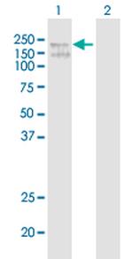 ADAR Antibody in Western Blot (WB)