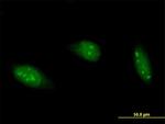 ADARB1 Antibody in Immunocytochemistry (ICC/IF)