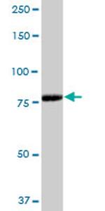 ADARB1 Antibody in Western Blot (WB)