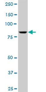 ADARB1 Antibody in Western Blot (WB)