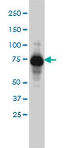 ADD1 Antibody in Western Blot (WB)