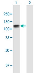 ADD2 Antibody in Western Blot (WB)