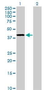 ADH4 Antibody in Western Blot (WB)