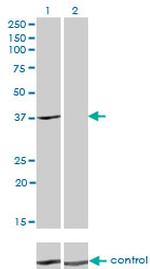 ADH4 Antibody in Western Blot (WB)