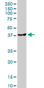 ADH4 Antibody in Western Blot (WB)