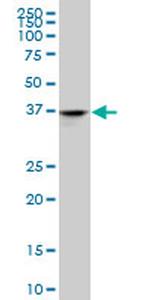 ADH4 Antibody in Western Blot (WB)