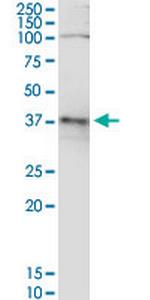 ADH5 Antibody in Western Blot (WB)