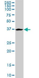 ADH6 Antibody in Western Blot (WB)