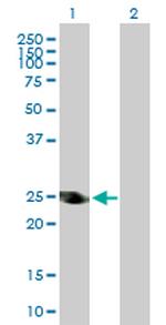 ADH6 Antibody in Western Blot (WB)