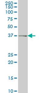 ADH6 Antibody in Western Blot (WB)