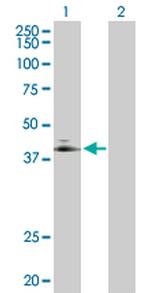 ADORA2A Antibody in Western Blot (WB)