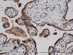 ADPRH Antibody in Immunohistochemistry (Paraffin) (IHC (P))