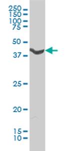 ADRA1A Antibody in Western Blot (WB)