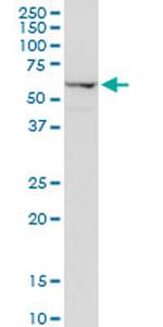 AGER Antibody in Western Blot (WB)