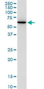 AGER Antibody in Western Blot (WB)