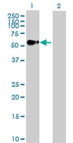 AGER Antibody in Western Blot (WB)