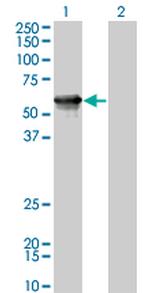 AGER Antibody in Western Blot (WB)