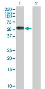 AGT Antibody in Western Blot (WB)