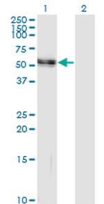 AGT Antibody in Western Blot (WB)