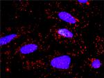 AKT1 Antibody in Proximity Ligation Assay (PLA) (PLA)