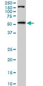 AKT1 Antibody in Western Blot (WB)