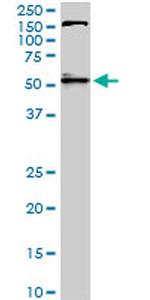 AKT1 Antibody in Western Blot (WB)