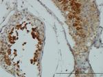 AKT1 Antibody in Immunohistochemistry (Paraffin) (IHC (P))