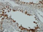 AKT1 Antibody in Immunohistochemistry (Paraffin) (IHC (P))