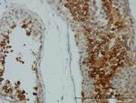 AKT1 Antibody in Immunohistochemistry (Paraffin) (IHC (P))