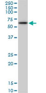 AKT1 Antibody in Western Blot (WB)