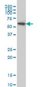 AKT1 Antibody in Western Blot (WB)