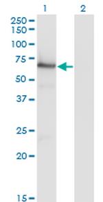 AKT1 Antibody in Western Blot (WB)