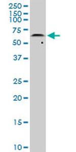 AKT2 Antibody in Western Blot (WB)