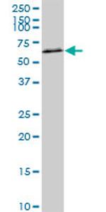 AKT2 Antibody in Western Blot (WB)