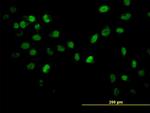 AKT2 Antibody in Immunocytochemistry (ICC/IF)