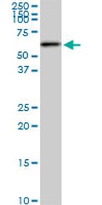 AKT2 Antibody in Western Blot (WB)