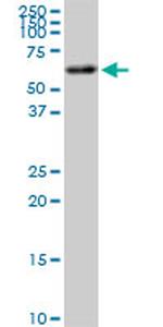 AKT2 Antibody in Western Blot (WB)